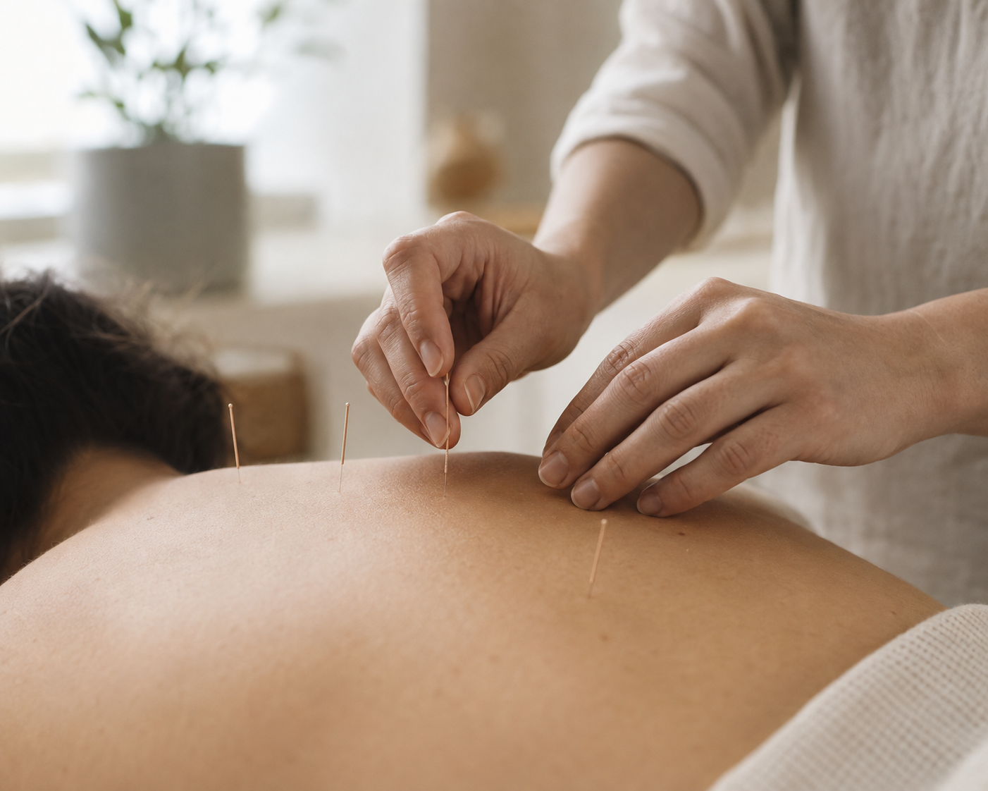 Acupuncturist plaatst zorgvuldig dunne naalden tijdens een behandeling